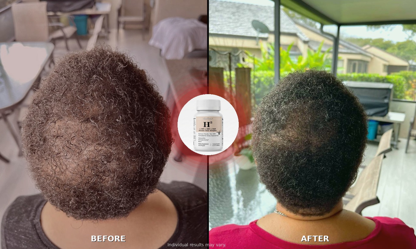 Before and after hair growth results